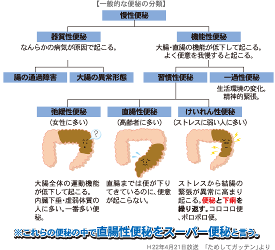 便秘の分類