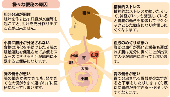 様々な便秘の原因